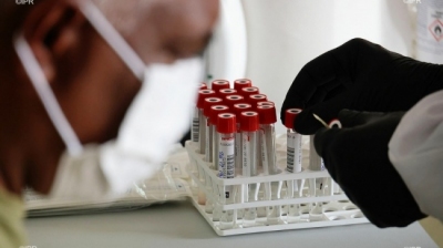 1.038 nouveaux cas en sept jours et un taux d'incidence à la ... Image 1
